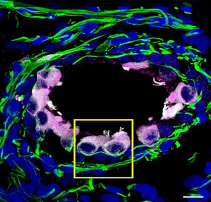 Inner ear organoid Inner ear organoid