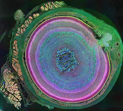 Photograph of retina Photograph of retina