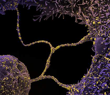 Novel Coronavirus SARS-CoV-2 Novel Coronavirus SARS-CoV-2