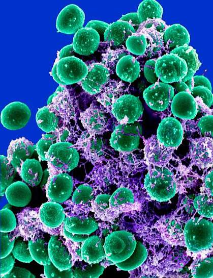 Staphylococcus epidermidis bacteria Scanning electron micrograph of a clump of Staphylococcus epidermidis bacteria