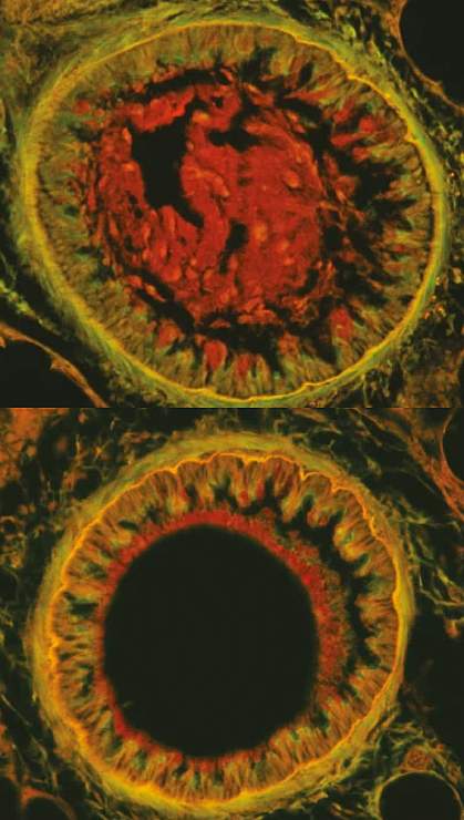 Mouse bronchial airways Cross sections show an untreated bronchial airway with mucus inside compared to a treated airway that is clear of mucus