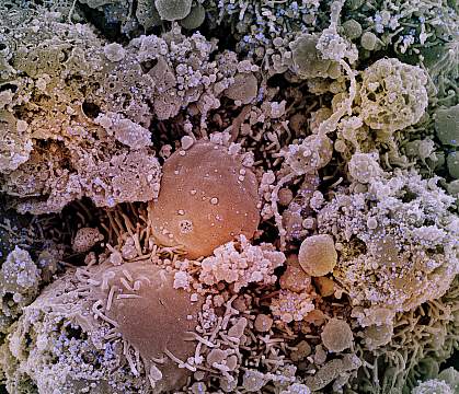 Cells infected with SARS-CoV-2