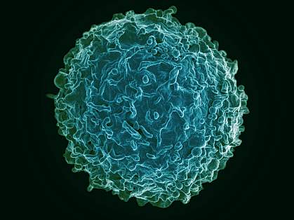 Colorized scanning electron micrograph of a B cell Colorized scanning electron micrograph of a B cell