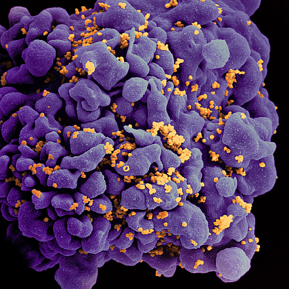 T cell covered with numerous virus particles