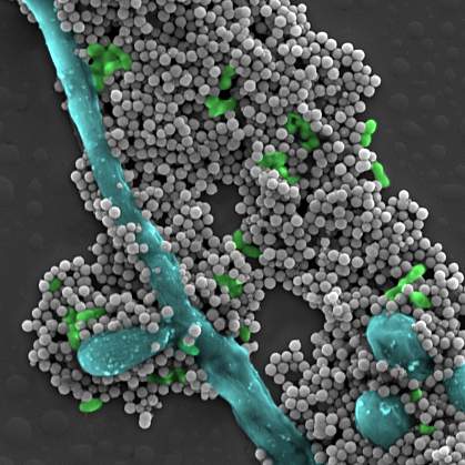 Scanning electron micrograph shows dozens of tiny gray magnetic spheres alongside common oral microbes. Scanning electron micrograph shows dozens of tiny gray magnetic spheres alongside common oral microbes.