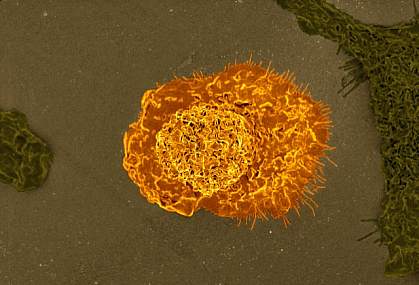 Colorized scanning electron micrograph of a macrophage. Colorized scanning electron micrograph of a macrophage.