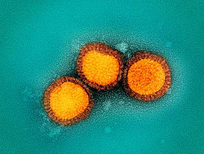 Colorized electron micrograph of three round virus particles Colorized electron micrograph of three round virus particles