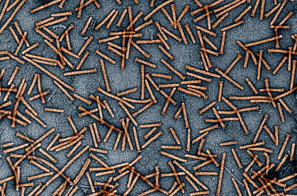 Transmission electron micrograph of numerous thin, rod-like Photorhabdus virulence cassettes Transmission electron micrograph of numerous thin, rod-like Photorhabdus virulence cassettes