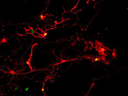 Retinal neurons glowing red, some with green nuclei Retinal neurons glowing red, some with green nuclei