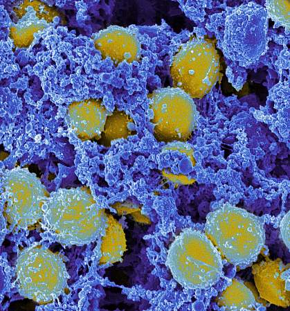 Scanning electromicrograph of Staphylococcus aureus bacteria