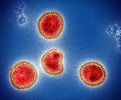 Circular influenza B virus particles Colorized electron micrograph of circular influenza B virus particles