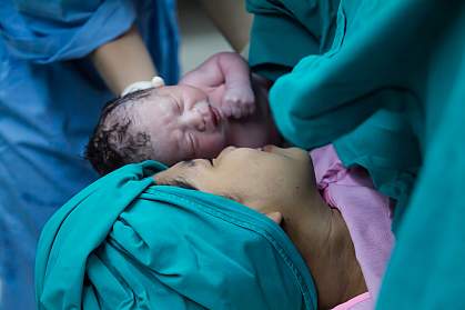 Mom and her newborn first meeting in operation room.