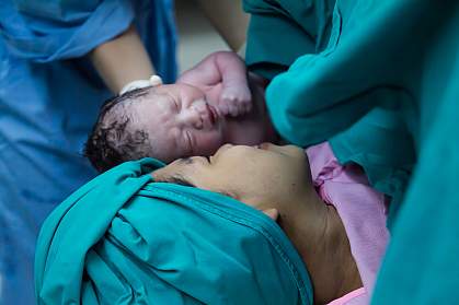 Mom and her newborn first meeting in operation room. Mom and her newborn first meeting in operation room.