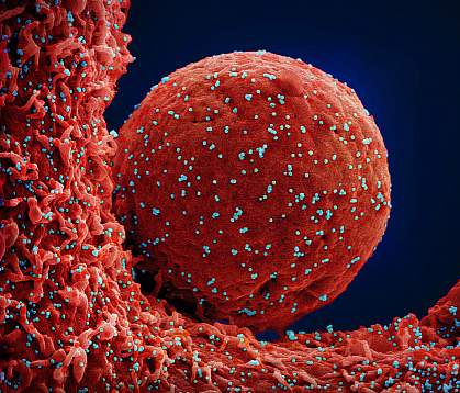 Novel Coronavirus SARS-CoV-2 Novel Coronavirus SARS-CoV-2