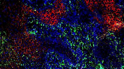 Immunofluorescence image with an area of disordered cells.