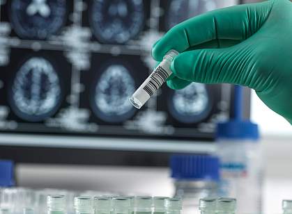 Gloved hand holding a test tube with brain images in background Gloved hand holding a test tube with brain images in background