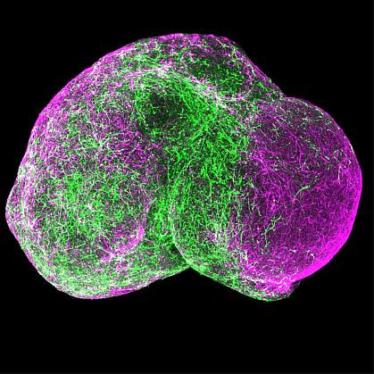 Image of a spherical organoid. Image of a spherical organoid.