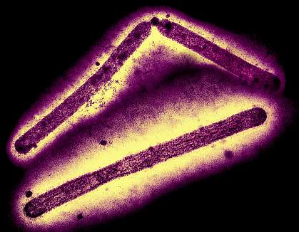 Transmission electron micrographs of three rod-shaped virus particles that have been inverted, repositioned, and colorized. Transmission electron micrographs of three rod-shaped virus particles that have been inverted, repositioned, and colorized.