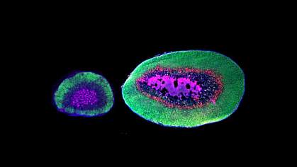 Microscope images of adrenal gland from a deer mouse and a larger one from an oldfield mouse with an additional layer of cells Microscope images of adrenal gland from a deer mouse and a larger one from an oldfield mouse with an additional layer of cells.