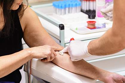 Cotton swab pressed onto a woman’s arm after blood collection. Cotton swab pressed onto a woman’s arm after blood collection.