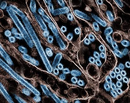 Electron micrograph shows long rods and circular cross-sections of virus particles. Electron micrograph shows long rods and circular cross-sections of virus particles.