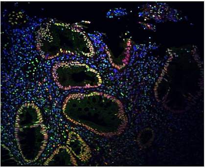 SUMO patterns in colon. Immunofluorescence signal is strong in the epithelial cells surrounding colon spaces.