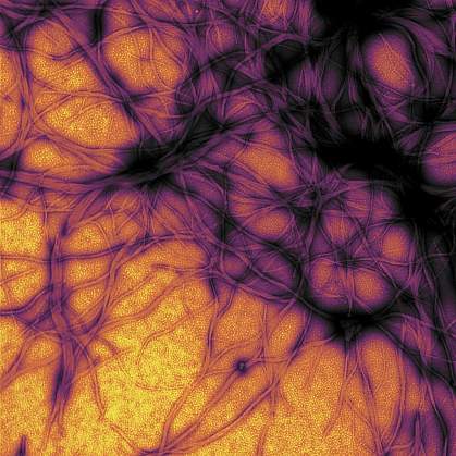 Colorized electron micrograph of prion protein fibrils. Colorized electron micrograph of prion protein fibrils.