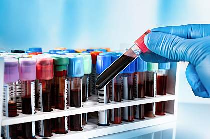 Gloved hand holding a test tube with a blood sample. Gloved hand holding a test tube with a blood sample.