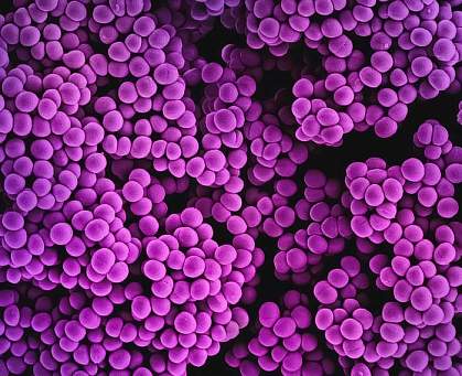 Methicillin-resistant Staphylococcus aureus, or MRSA, bacteria. Methicillin-resistant Staphylococcus aureus, or MRSA, bacteria.