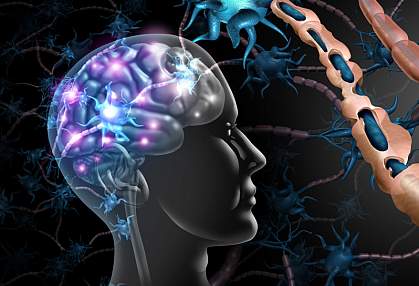 Illustration showing a brain artistically lit up from an immune attack and a close-up of damaged myelin around a nerve. Illustration showing a brain artistically lit up from an immune attack and a close-up of damaged myelin around a nerve.