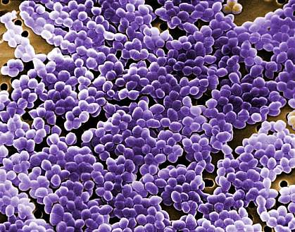Digitally colorized scanning electron microscopic image showing large field of Enterococcus bacteria. Digitally colorized scanning electron microscopic image showing large field of Enterococcus bacteria.