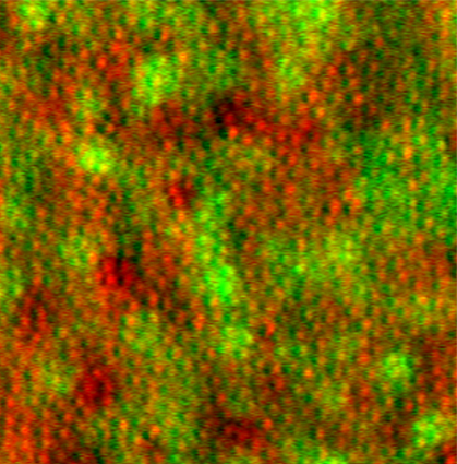 Microscopic image of a retina.