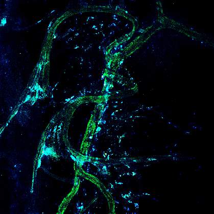 Confocal microscopy image shows Treg cells clustered next to long nerve cells. Confocal microscopy image shows Treg cells clustered next to long nerve cells.