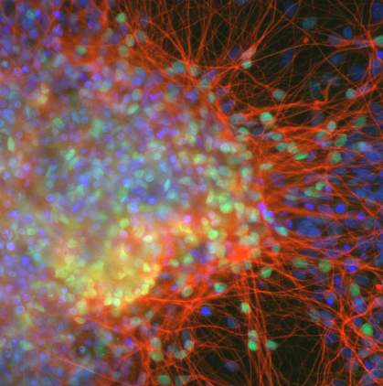 Cortical neurons derived from iPS cells Cortical neurons derived from iPS cells.