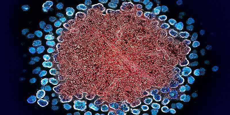 Numerous HIV particles surrounding a cell, with some emerging from it