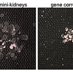  Two photos of tissue chips. The one on the left shows mini-kidneys with homozygous PKD mutations, the one on the right shows gene-corrected heterozygotes. 