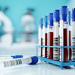 A row of human blood samples in a medical laboratory ready to be tested. healthcare background 3D illustration.