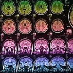 The X-ray of the human brain