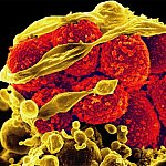 Methicillin-Resistant Staphylococcus aureus (MRSA) Bacteria