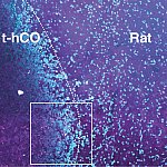 Image showing transplanted human cortical organoids made from cells taken from individuals with Timothy syndrome with immunostaining. 