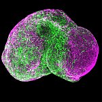 Image of a spherical organoid.